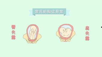 胎位操视频教程,轻松掌握孕期保健操，助力宝宝健康发育